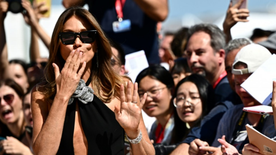 S&auml;ngerin Carla Bruni macht &uuml;berstandene Brustkrebserkrankung &ouml;ffentlich