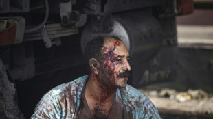 Eighteen killed, fires still burning in huge Iran port blast