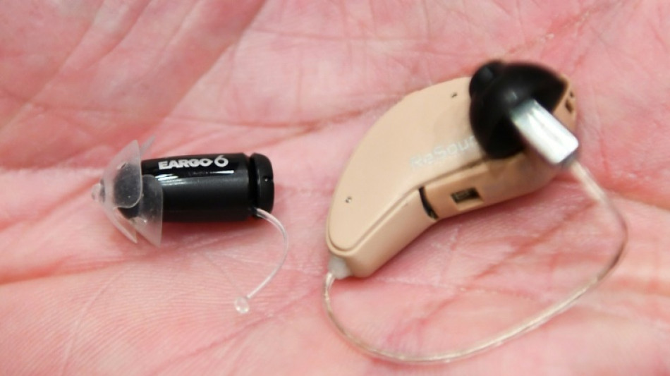 Fraudes en France: les margoulins de l'audioproth&egrave;se dans le collimateur de la S&eacute;cu