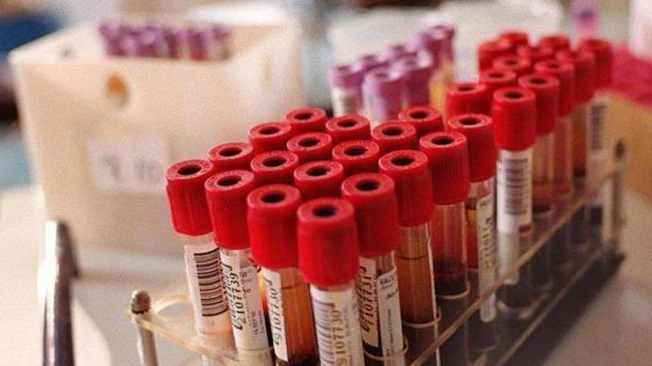 Un prelievo di sangue in futuro potr&agrave; prevedere l'efficacia della chemio