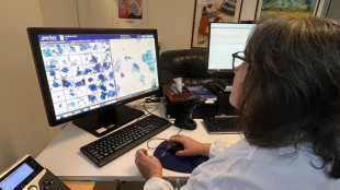 L'intelligenza artificiale per lo screening del tumore a utero