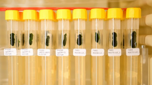 Comment la lumi&egrave;re combin&eacute;e &agrave; la g&eacute;n&eacute;tique permet-elle de percer les myst&egrave;res du cerveau ?