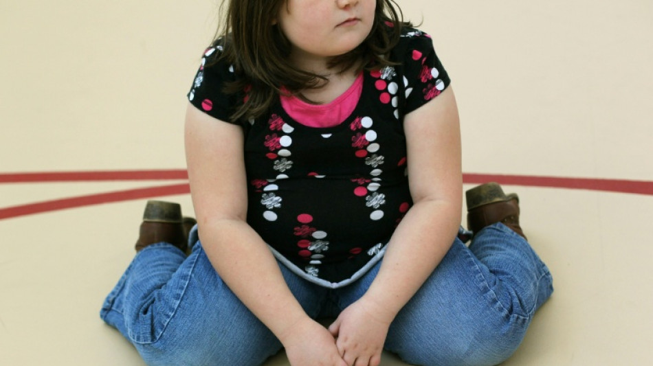 La obesidad supera por primera vez a la desnutrici&oacute;n entre los menores de 5 a 19 a&ntilde;os, advierte Unicef