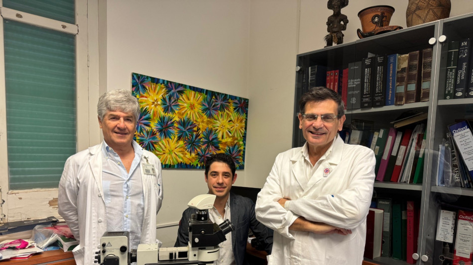 Scoperta una nuova classe di farmaci che silenzia il virus Hiv