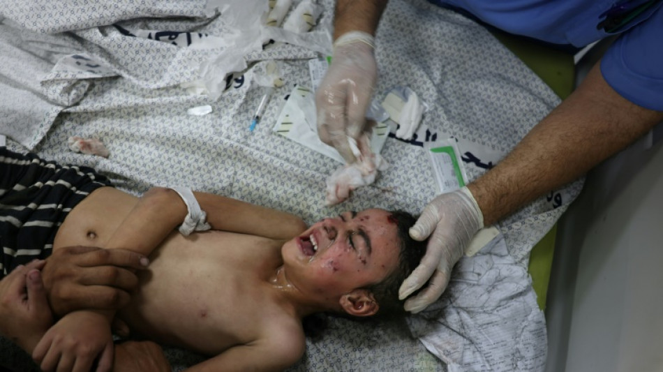 Los gazat&iacute;es, bajo las bombas: "&iexcl;No hemos hecho nada!"